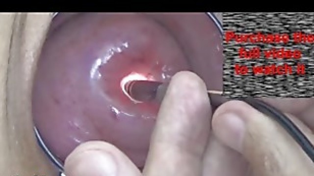 Japanese Endoscope Cam inside Cervix and Pussy